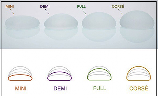 Motiva implants profile projection Image