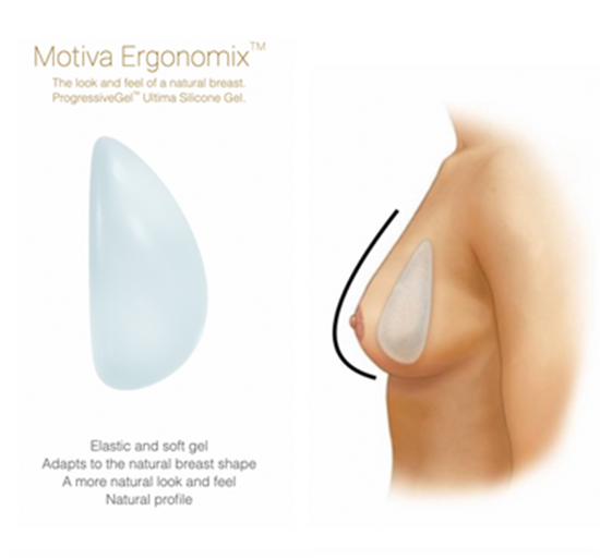 Motiva Implants — For a NATURAL look