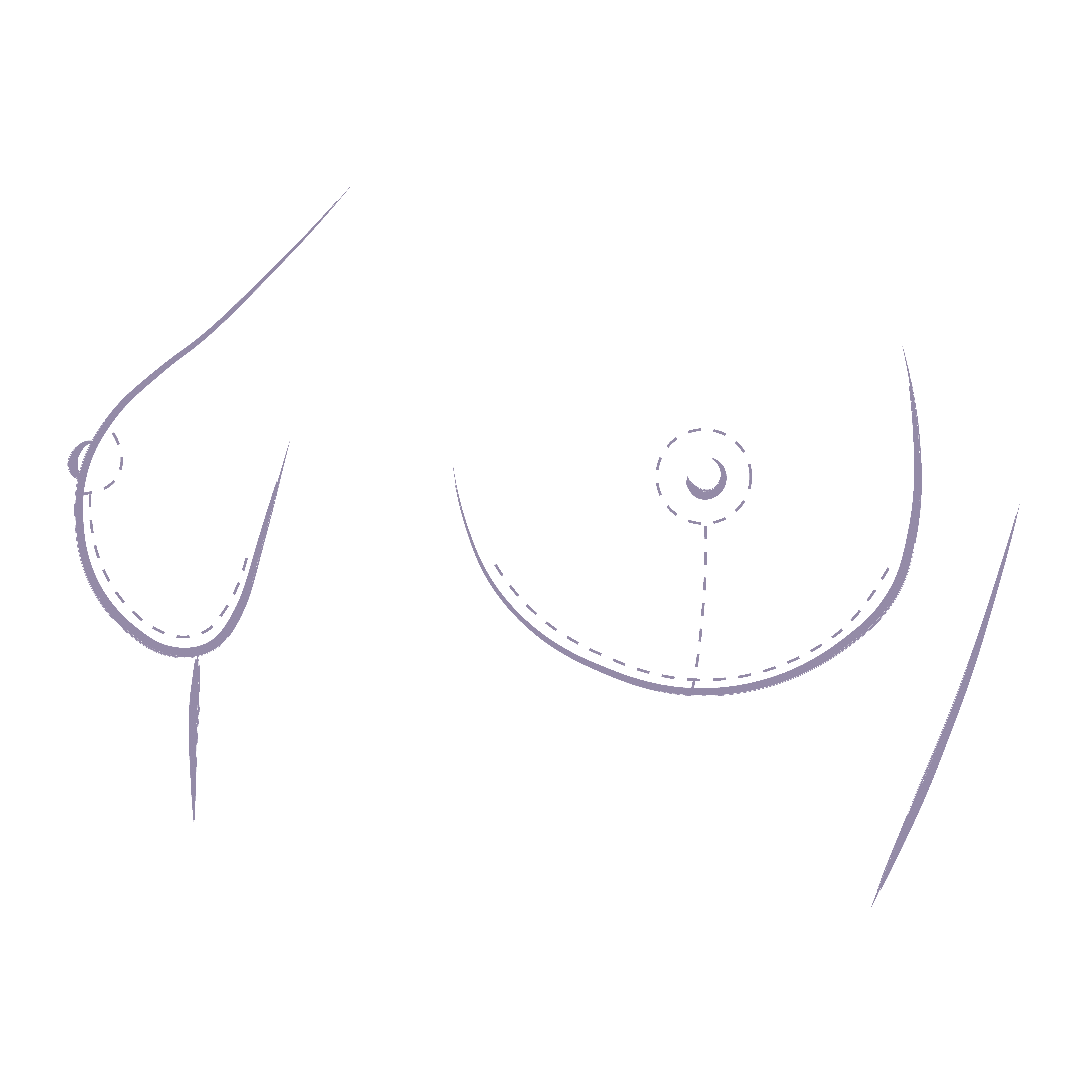 Breast Lift Without Implants - Effective Surgical Options