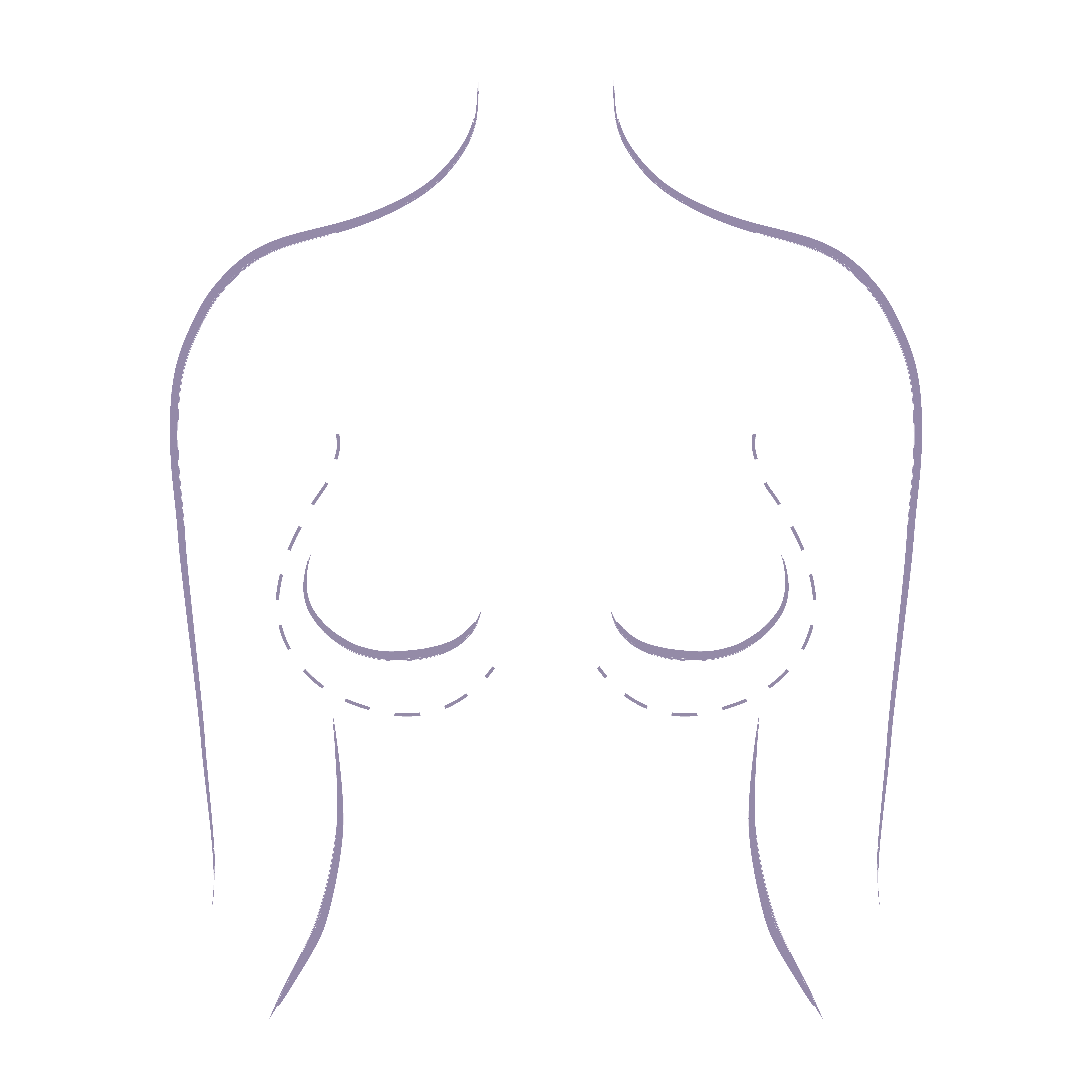 An image design of how a breast augmentation with implants can increase the volume and size of a female's breasts.