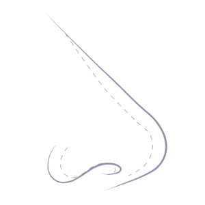 Illustration demonstrating the common nose concerns relating to a long nose that is out of proportion to the face. 
