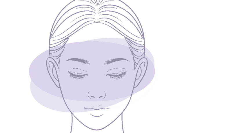 Complete Guide to Managing Upper Eyelid Blepharoplasty Scars - Me Clinic Featured Image Small
