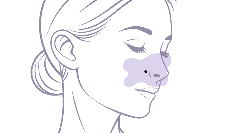 How To Remove A Mole Image orig withbackground cropped