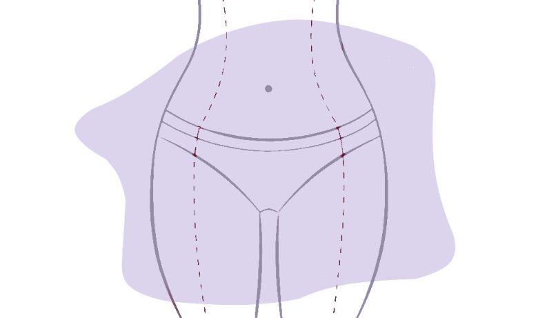 Liposuction Vs Weight Loss Surgery Image with background cropped