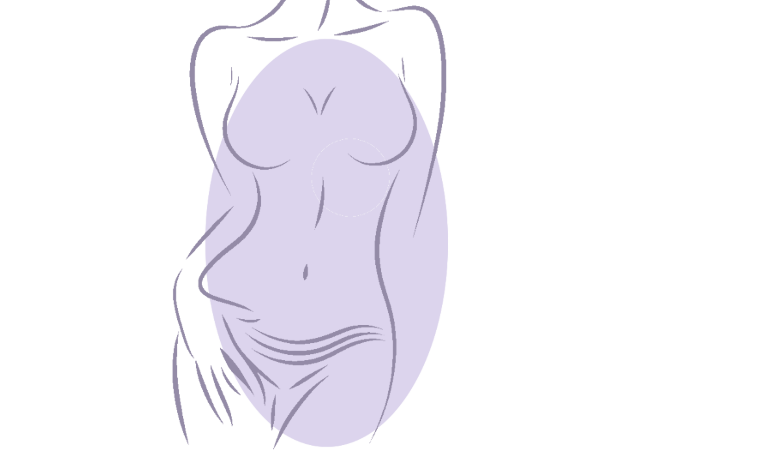 Recovery After Liposuction - to Expect How to Maximise Healing Featured Image